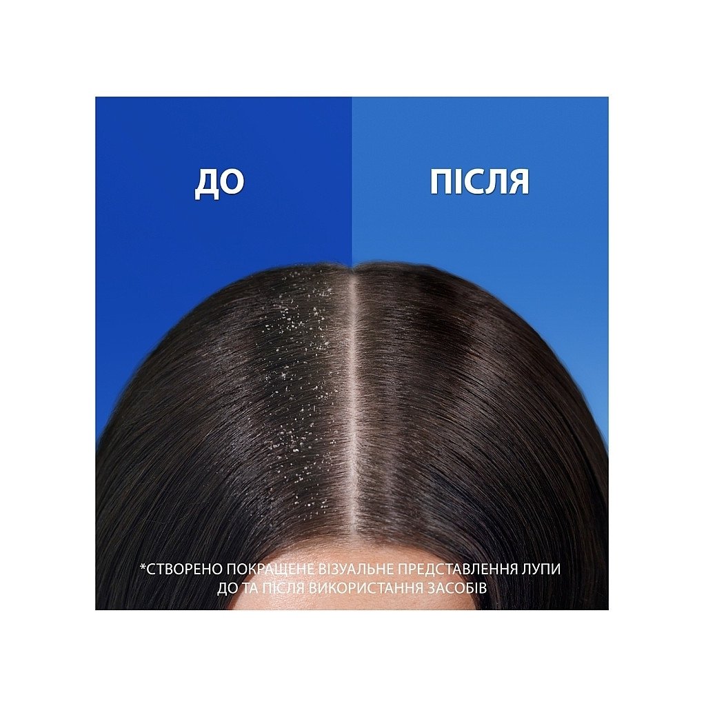 Шампунь Head & Shoulders 2 в 1 Проти лупи Гладеньке та шовковисте 330 мл (8700216304856)