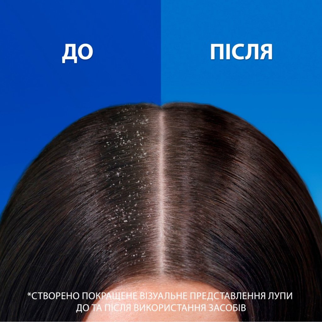 Шампунь Head & Shoulders Pro-Expert 7 Захист від випадіння волосся З кофеїном 250 мл (8700216156936)